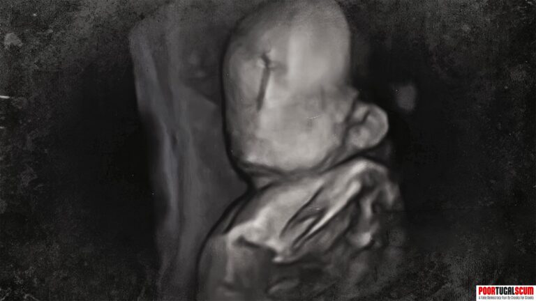 Ultrasound of baby without a face in Portugal
